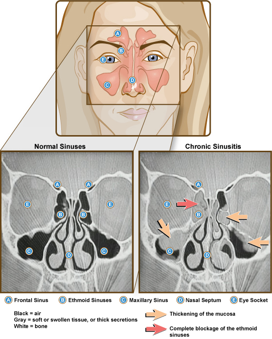 Sinus Graphic